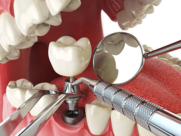 Best Emergency Cosmetic Dentistry (e.g., broken veneers) in Perryville, MD